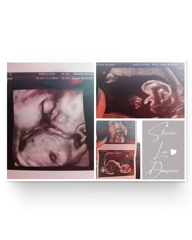 fbec566fe699c957dc2e3252371f1b136e90511000f15d4b25380fdd8aa5fdab